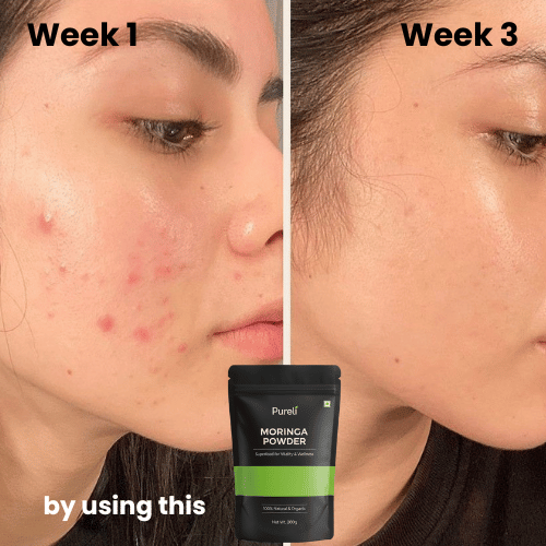 Pureli Real Greens. Real Results (Detox Powder)